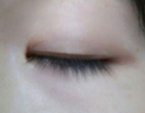 单眼皮变双眼皮视频,神奇美眼术揭秘